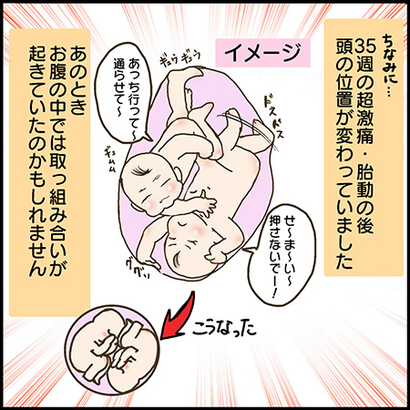 私が双子を妊娠するなんて14-5