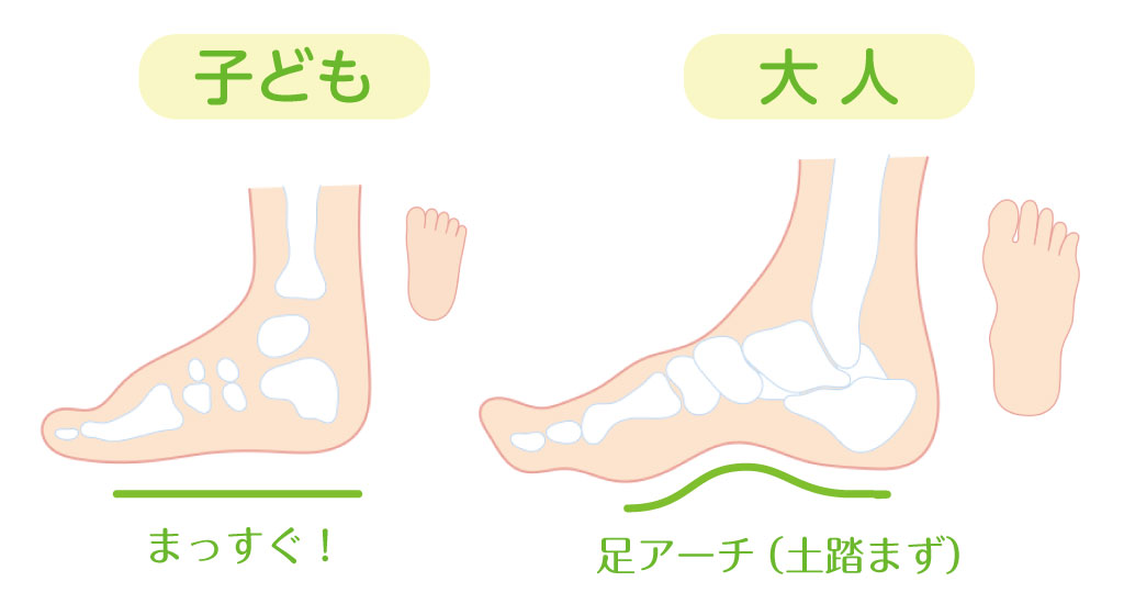 子どもはみんな扁平足！