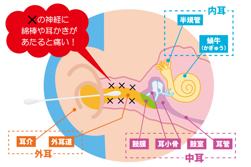 自宅での正しい耳垢取りの方法